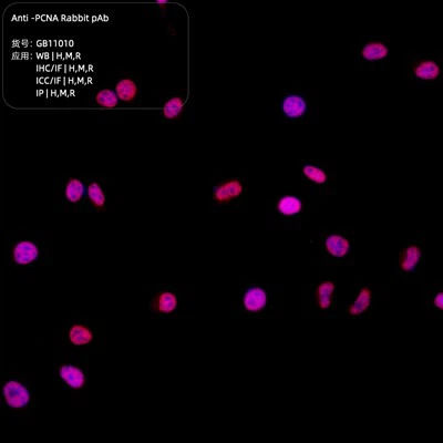 PAb kháng PCNA thỏ